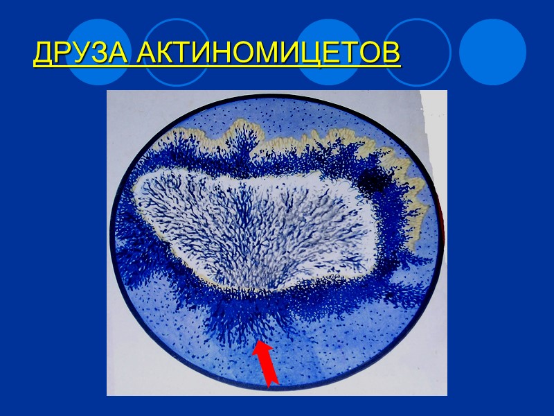 Патогенез актиномикоза Заболевание возникает при снижении иммунитета при травматизации слизистых (у стоматолога) Размножение в