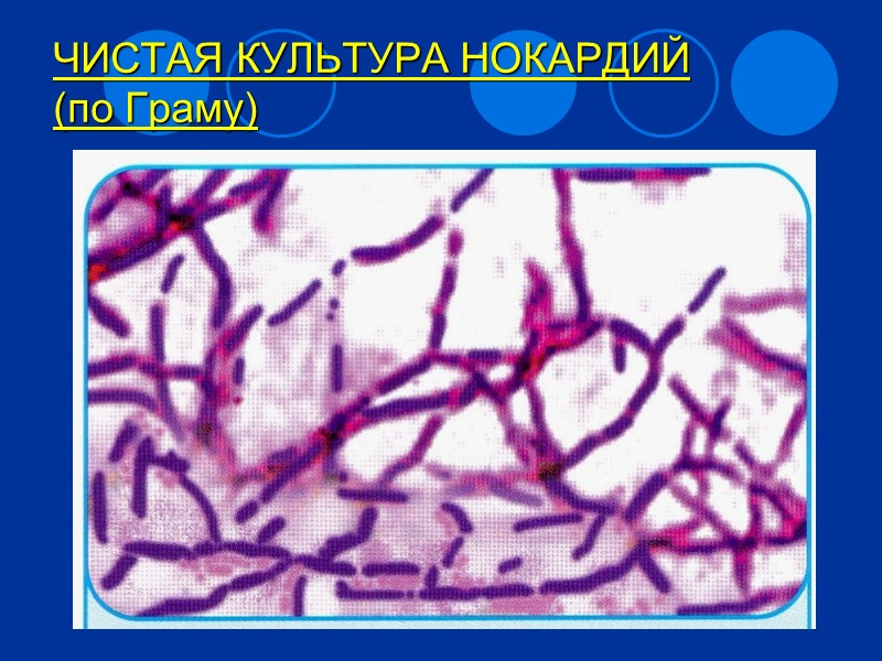 КЛАССИФИКАЦИЯ ДОМЕН ТИП КЛАСС ПОРЯДОК СЕМЕЙСТВО РОД ВИД Bacteria   Actinomycetales Nocardia Nocardia