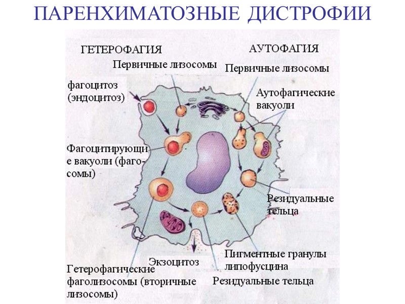 ПАРЕНХИМАТОЗНЫЕ ДИСТРОФИИ Гепатоциты при гликогенозе. В цито- плазме гепатоцита видны отграничен- ные мембраной скопления