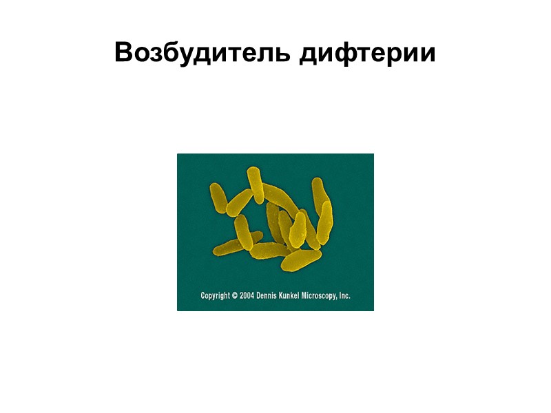 Дифтерия возбудитель