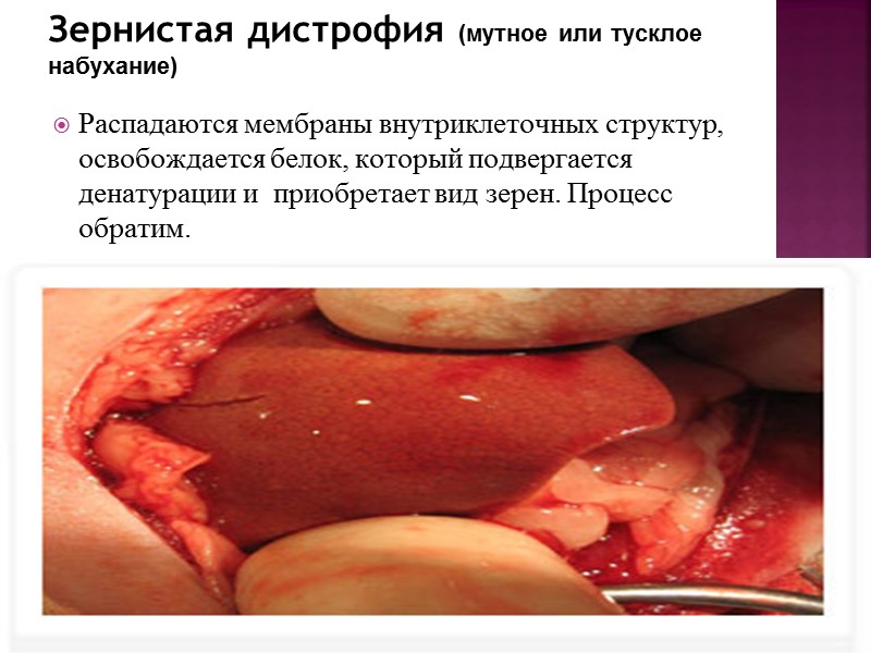 И.В.Ремезов, В.А.Дорошенко «Основы патологии», Ростов-на-Дону, «Феникс», 2008, стр. 24-39 Знать определения видов нарушения обмена