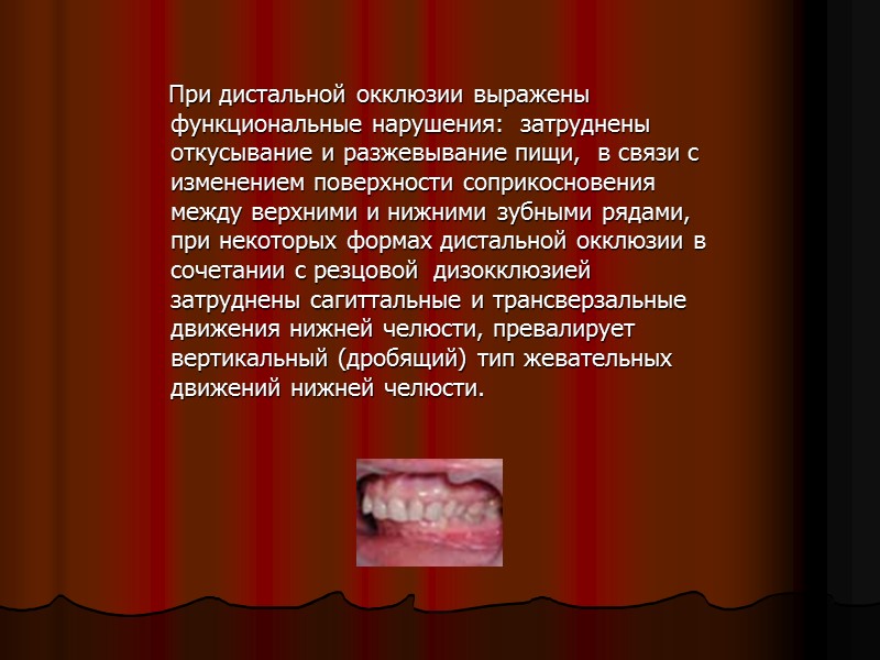 Диагностика:    осмотр больного  анализ диагностических моделей  ОПГ