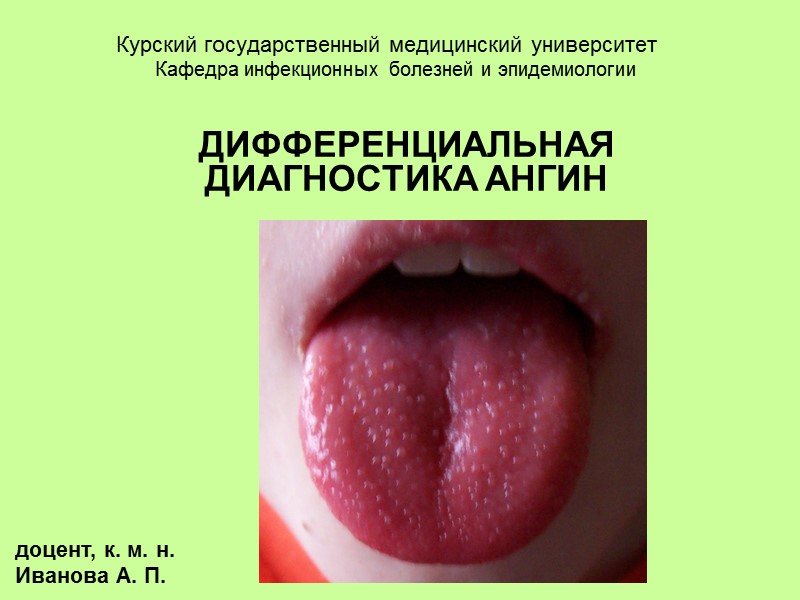 Курский государственный медицинский университет ДИФФЕРЕНЦИАЛЬНАЯ ДИАГНОСТИКА АНГИН Кафедра инфекционных болезней и эпидемиологии доцент, к.