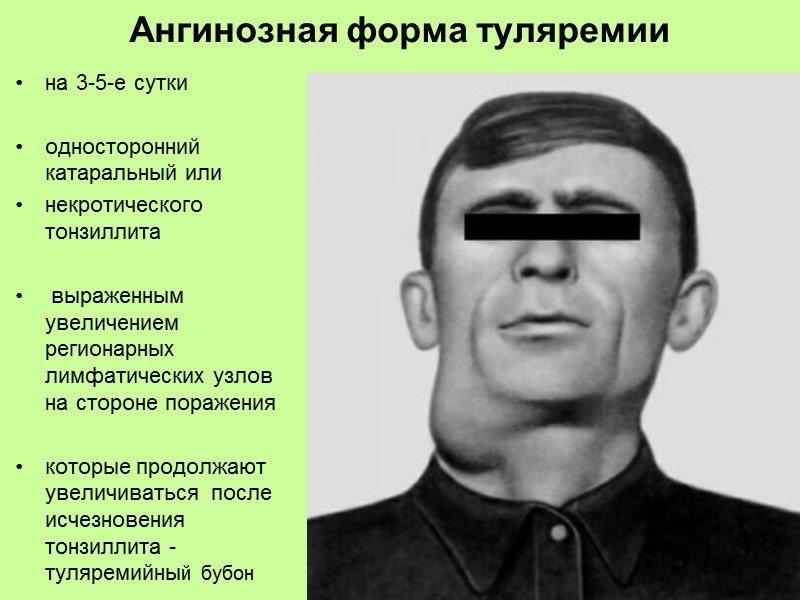 Скарлатина  обильной точечной сыпи  на гиперемированном фоне  сгущающейся на шее, боковых