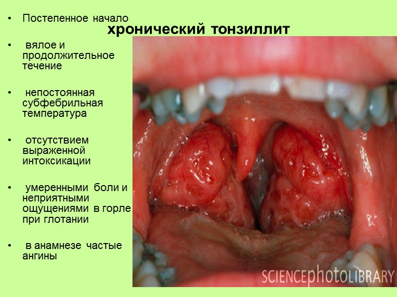 лейкоцитоз   нейтрофильного характера   со сдвигом формулы влево   повышение