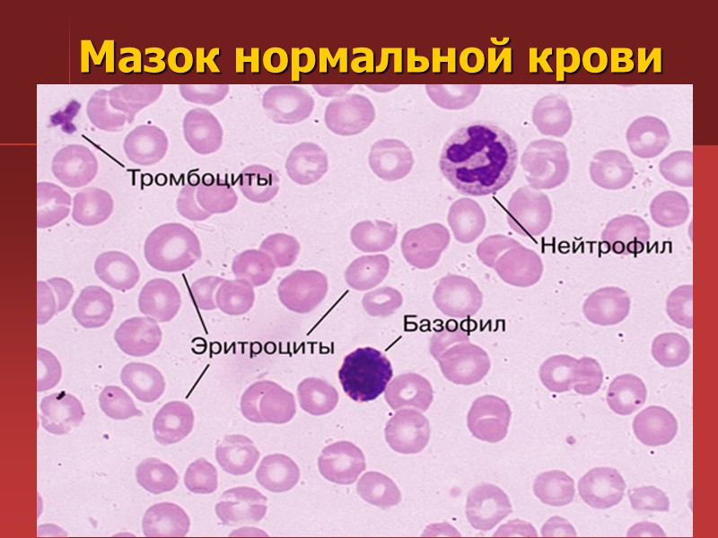 Включения в эритроцитах Включения в эритроцитах