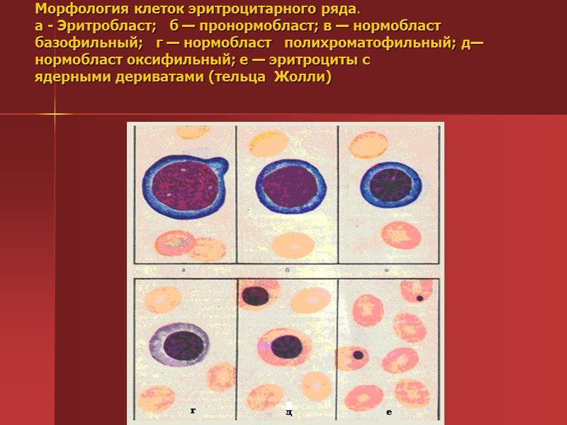 Нормоцит это. Эритробласт морфология. Бластные клетки и нормобласты. Полихроматофильный нормоцит. Полихроматофильный эритробласт.