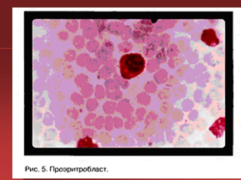 Воздействуют на этиологические факторы (удаление источника кровотечения, санация очагов инфекции, противоопухолевая терапия, профилактика врожденного Воздействуют на этиологические факторы (удаление источника кровотечения, санация очагов инфекции, противоопухолевая терапия, профилактика врожденного