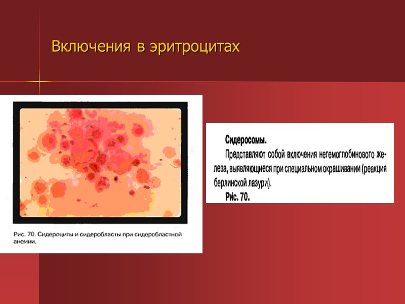 Включения в эритроцитах Включения в эритроцитах