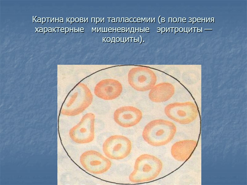 Приобретенные ГА: 1.связанные с воздействием антител (изоиммунные, аутоиммунные); 2.связанные с изменением структуры мембраны эритроцитов