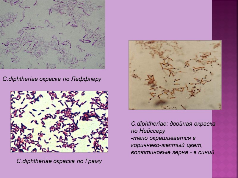 Бактериологический метод 1 этап: посев клинического материала на кровяной теллуритовый агар (среда Клауберга). 