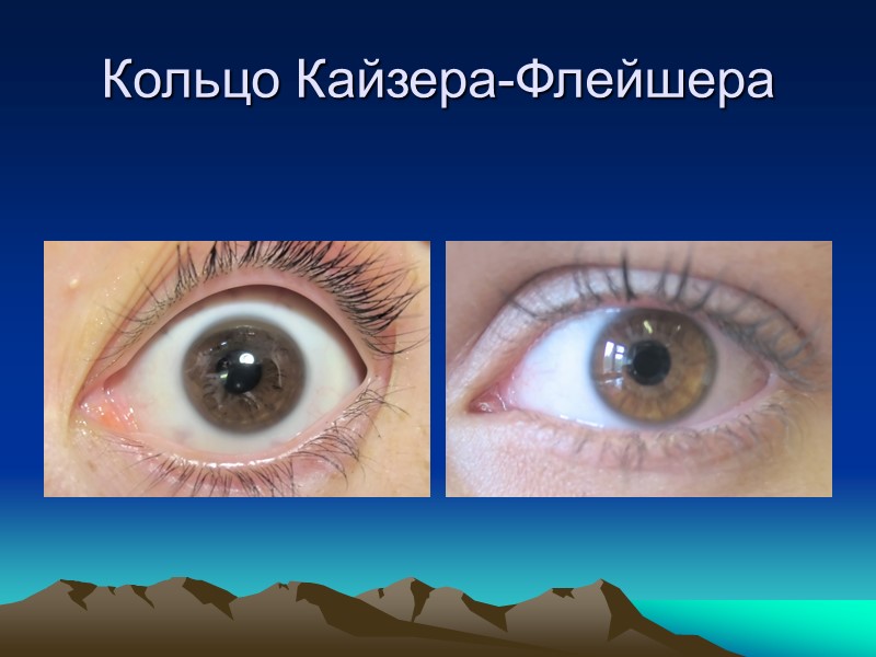 Инструментальные методы диагностики УЗИ органов брюшной полости – показатель для печени, транскраниальное УЗИ головного