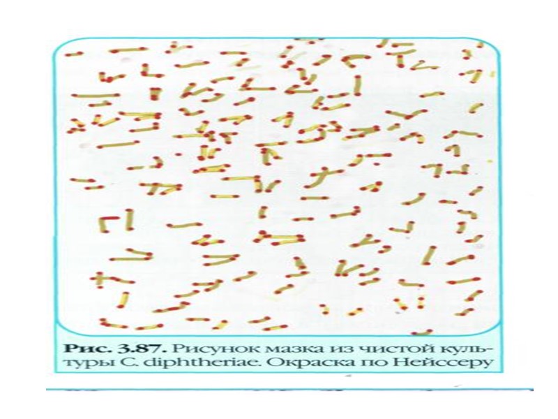 За систематикою бактерій Берги 1984 р. коринебактерії  відносяться до:  ц. Procariotae 