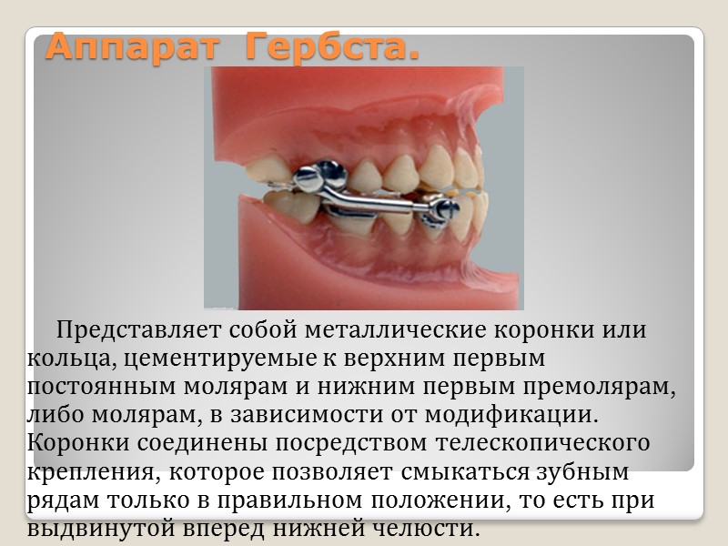Ограничения применения позиционеров: Скелетные виды аномалий;  Клинические случаи, когда необходимо удаление отдельных зубов;