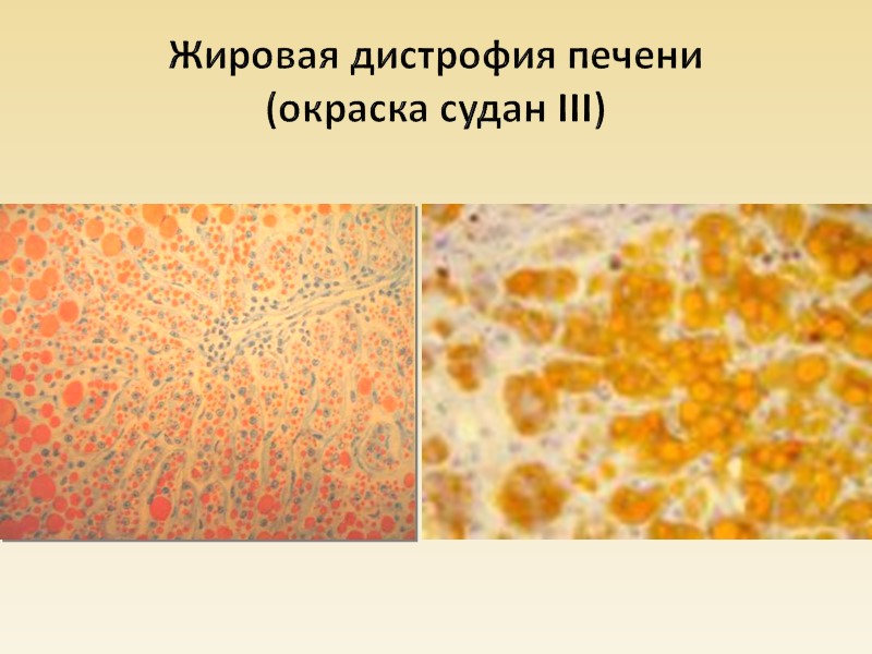 Лейкоплакия слизистой оболочки шейки матки