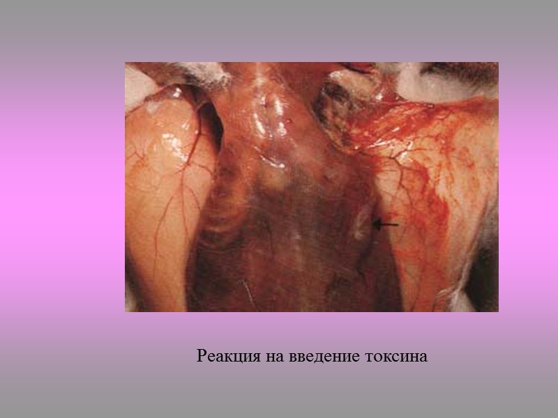 Corynebacterium diphtheriae, окраска по Нейссеру