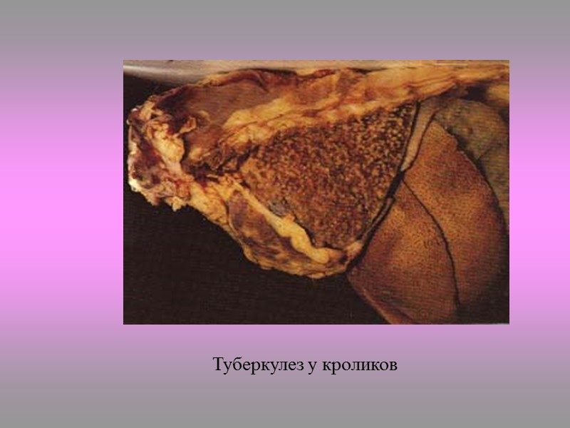 Рост туберкулезных палочек на среде Левенштейна-Йенсена