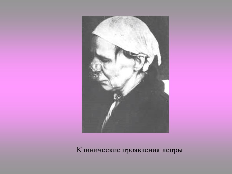 Культуральные свойства M. leprae – облигатные внутриклеточные паразиты, не растут на питательных средах. Экспериментальное