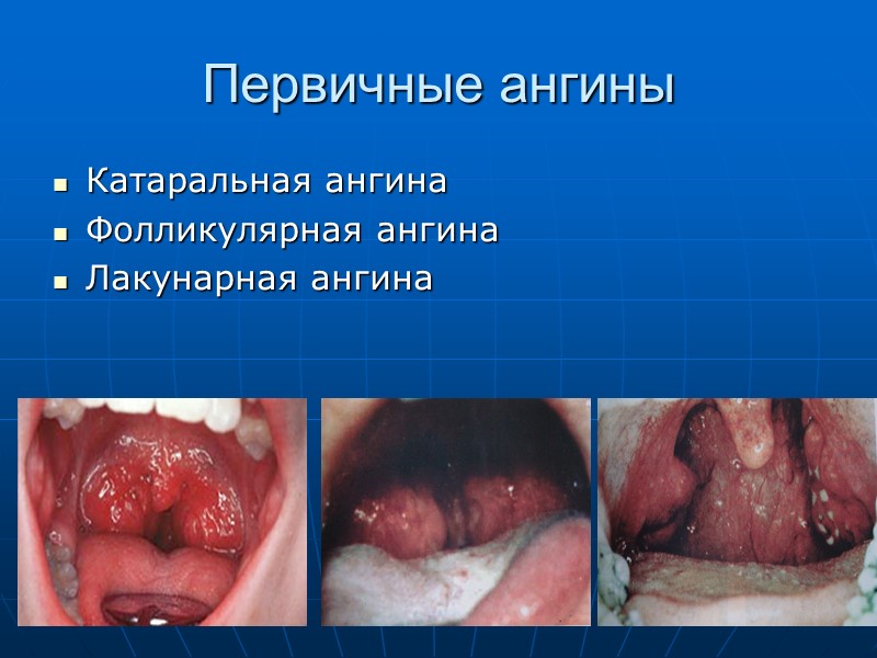 Дифтерия глаз