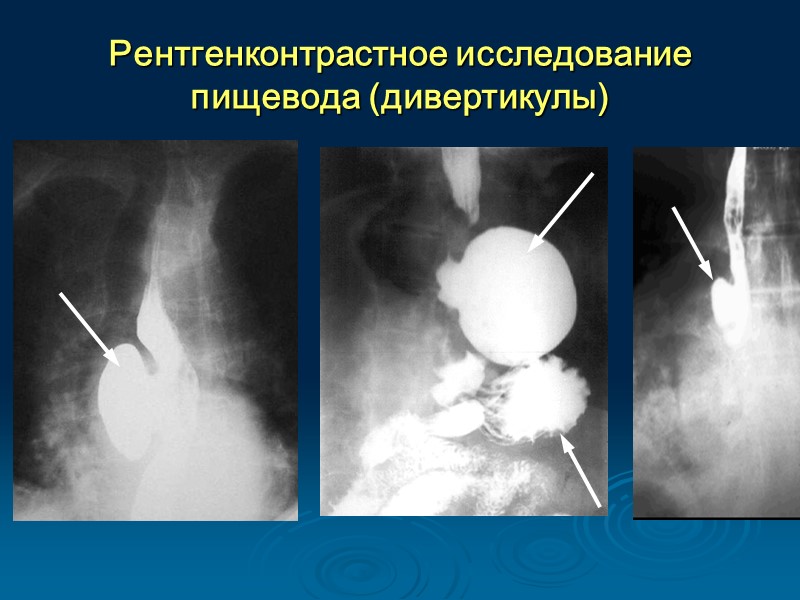 Исследования пищевода и желудка