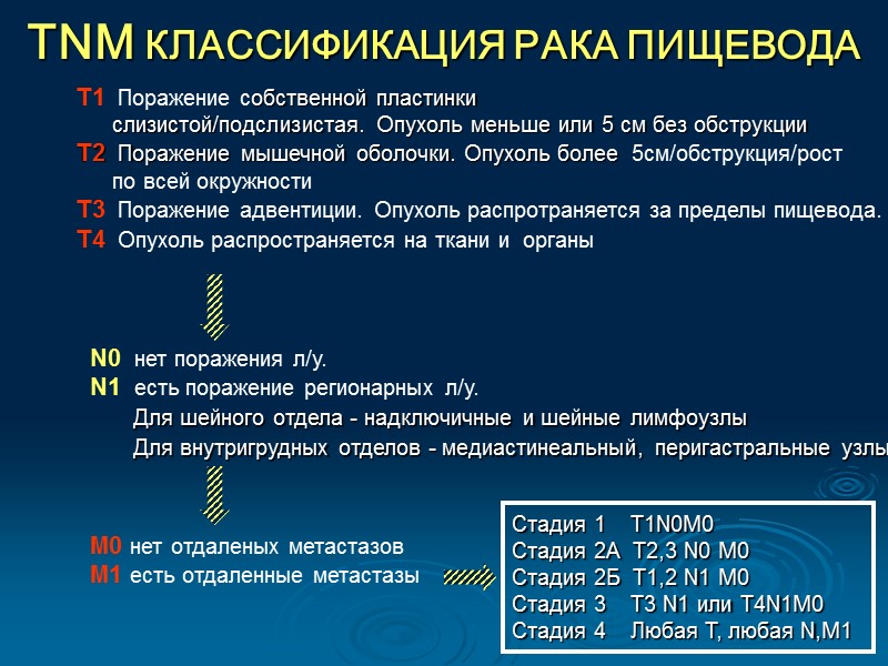 Какие стадии рака пищевода. Классификация TNM онкология. Классификация TNM пищевод. Стадия заболевания по TNM. ТНМ опухоли.