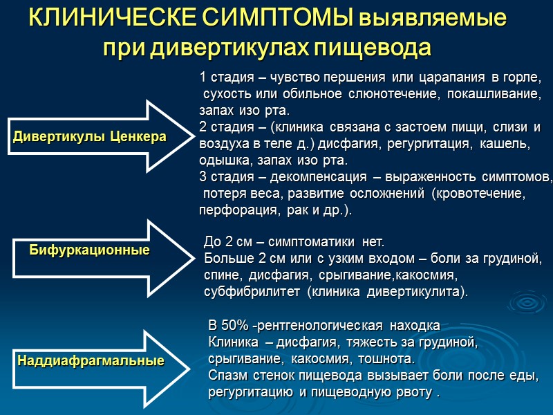 Дивертикулит пищевода