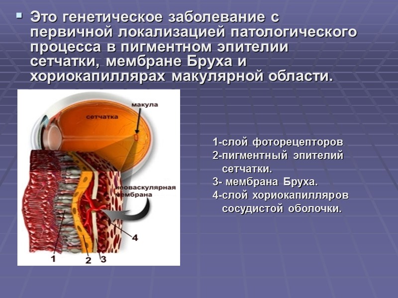 Макулярная область сетчатки