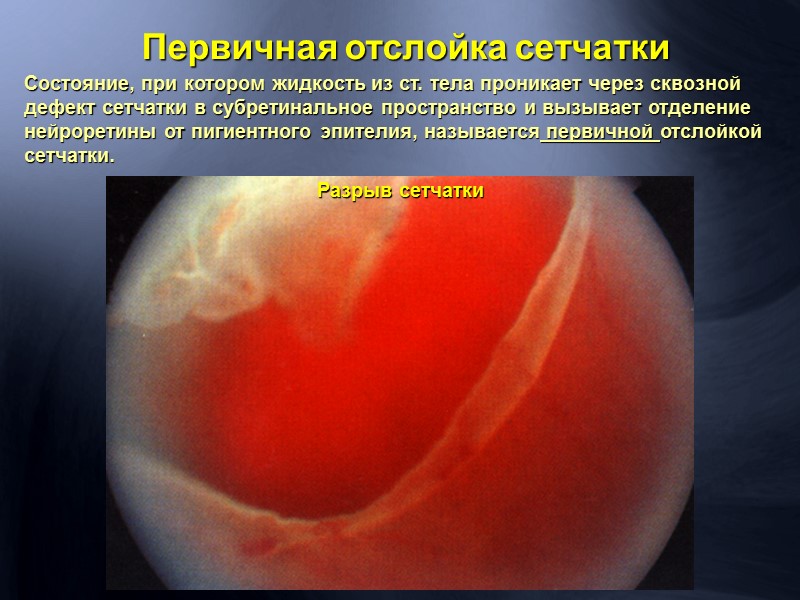 Флюоресцентная ангиография