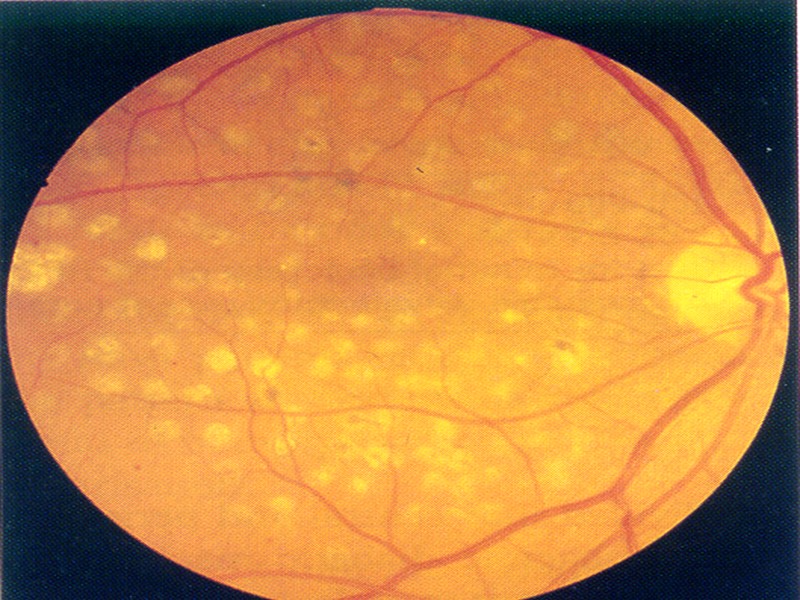 Палочки – 100 – 120 млн.   Колбочки – около 7 млн. 