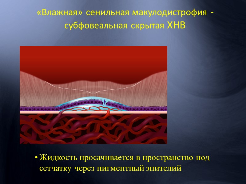 Риск потери зрения для пациента с СД в 20 раз (!) выше, чем в