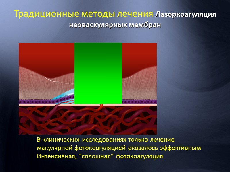 ДМО:  Фокальный  (не захватывает ГЦФ и имеет площадь  менее 2 ДД)