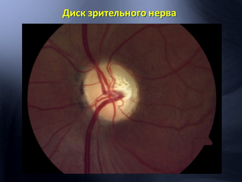 Артериовенозная фаза  показывает  единичные микроаневризмы в центральных отделах. Парафовеолярная аркада интактна