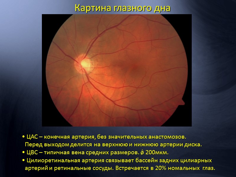 Поздняя фаза  - жесткий “leakage” красителя из области заднего полюса , включая парафовеолярные