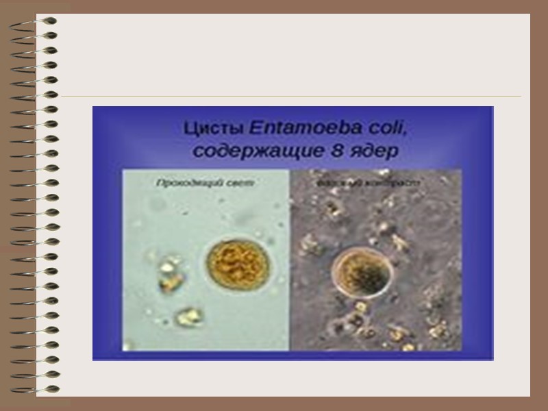 Entamoeba coli в кале. Механизм передачи амебиаза. Микробиологической диагностики амебиаза. Амебиаз диагностика ОАК. Амебиаз пути передачи.