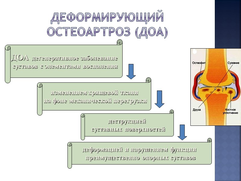 Классификация болезней суставов Болезни суставов Артриты  воспалительный процесс в синовиальной оболочке, суставном хряще