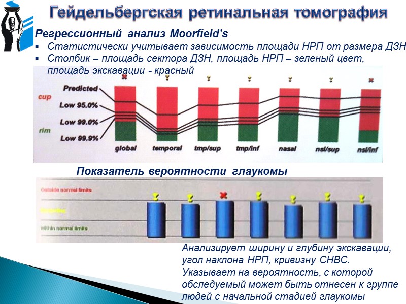 Флюоресцентная ангиография Гипофлюоресценция А. Блокирование веществом или тканью, непрозрачными для желто-зеленых лучей Киста сетчатки