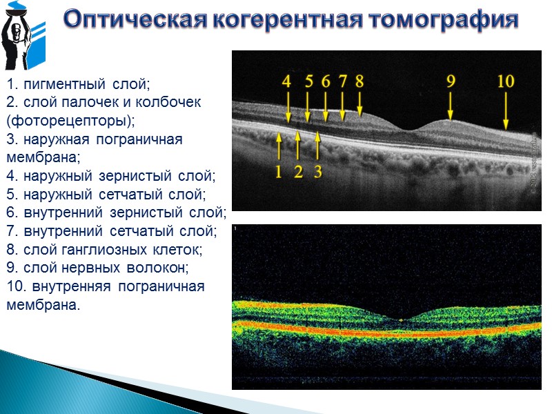 Оптическая томография