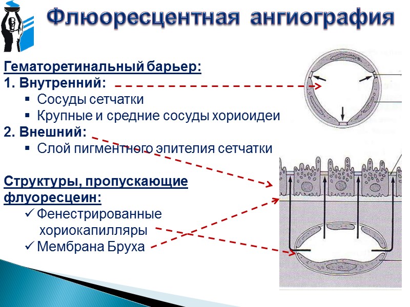 Гейдельбергская ретинальная томография Регрессионный анализ Moorfield’s Статистически учитывает зависимость площади НРП от размера ДЗН