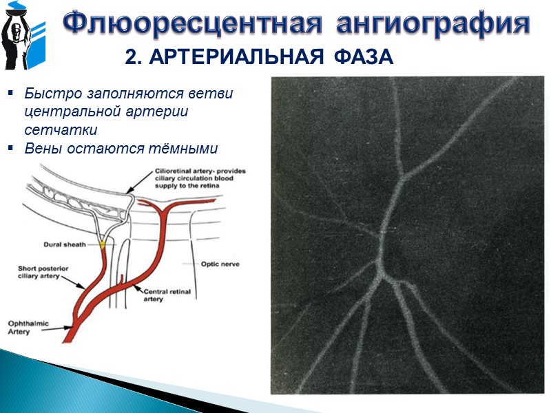 Оптическая когерентная томография Основа действия – определение времени задержки светового луча Источник света –