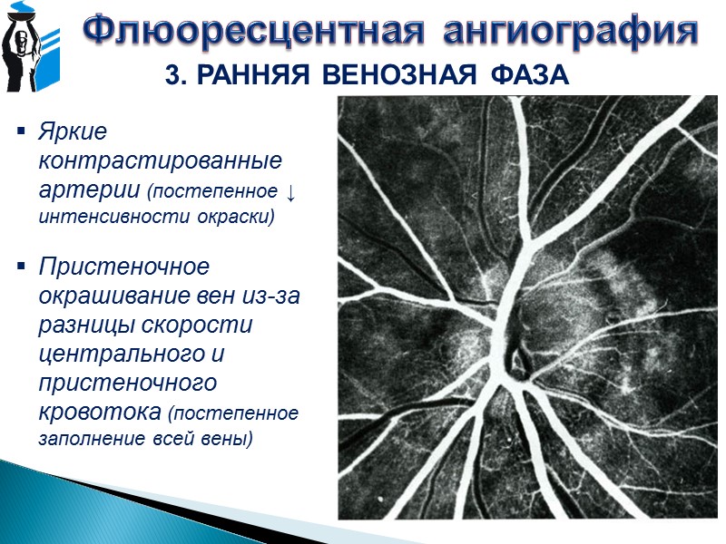 Оптическая когерентная томография 1. пигментный слой; 2. слой палочек и колбочек (фоторецепторы); 3. наружная