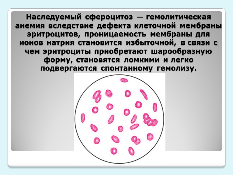 Классификация анемий Постгеморрагические   - острые   - хронические От нарушенного кроветворения
