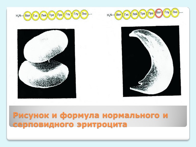 ОБЩИЕ:  -Бледность кожи, слизистой оболочки, полости рта, конъюнктивы, ногтевого ложа, кожных складок на