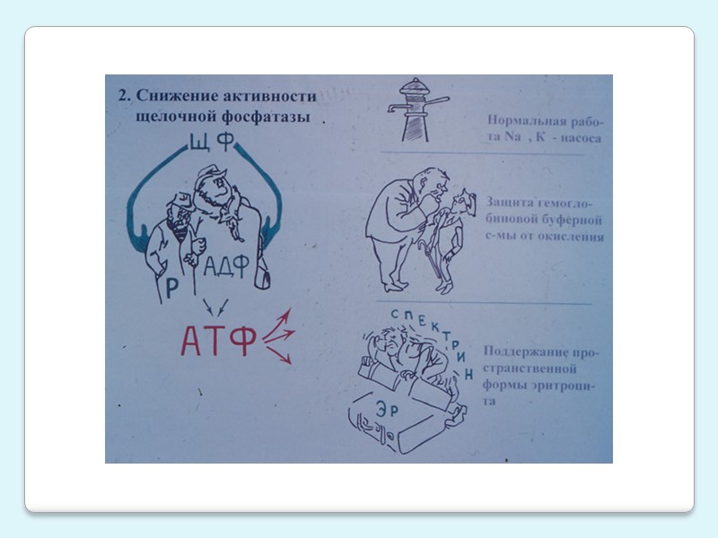 Железодефицитные состояния (ЖДС) –      клинико_-_гематологический симптомокомплекс, характеризующийся нарушением образования