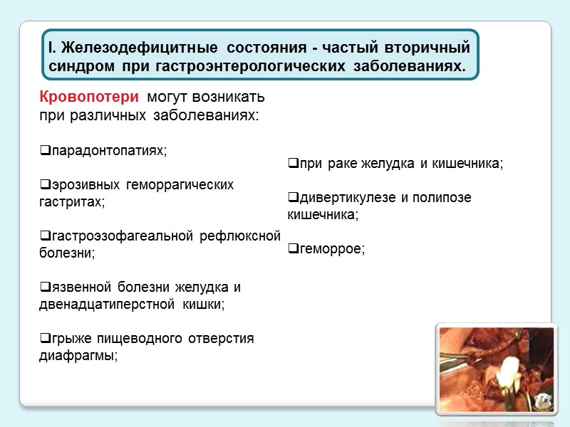 ПРИНЦИПЫ ТЕРАПИИ: гемотрансфузии при ЖДА должны проводиться только по жизненным показаниям;  терапия ЖДА