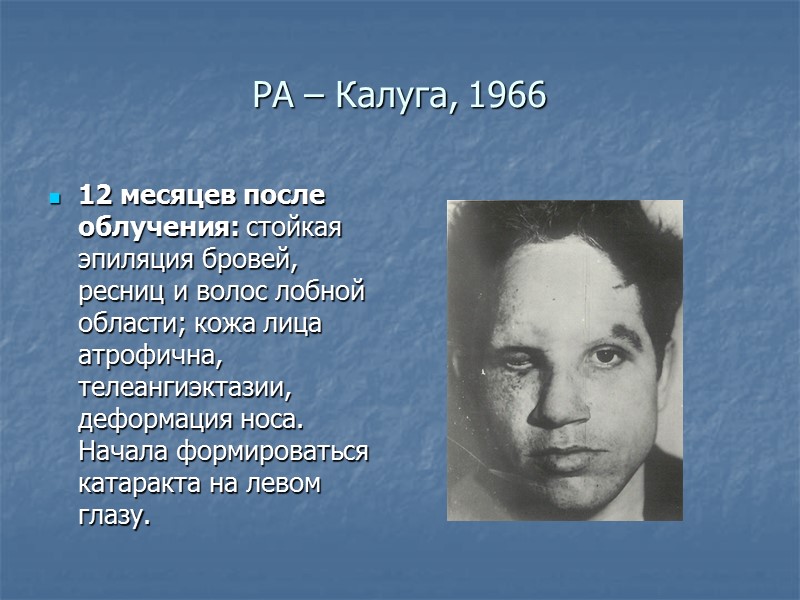 Численность персонала и средние дозы за 2010г. Для наиболее распространённых профессий и должностей