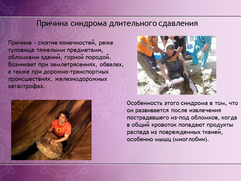 В клиническом течении СДС выделяют три периода: ранний - нарастания отека и сосудистой недостаточности