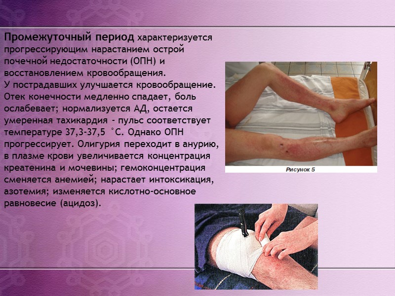 Оказания первой доврачебной помощи при СДС на месте происшествия: 1)Обезболивание до или параллельно с