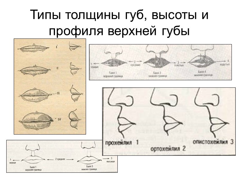 Уильям Герберт Шелдон  (Sheldon William Herbert, 1898–1977) Шелдон выделил три первичных (главных) компонента