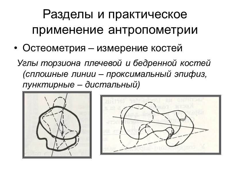 Уильям Герберт Шелдон  (Sheldon William Herbert, 1898–1977)  Определив число баллов по компонентам