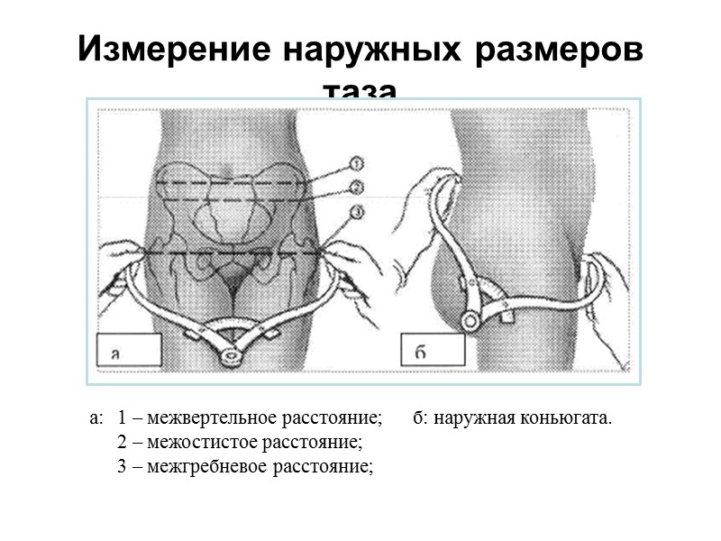 Дерматоглифика –  раздел физической антропологии, изучающий изменчивость гребешковых узоров и сгибательных борозд пальцев,